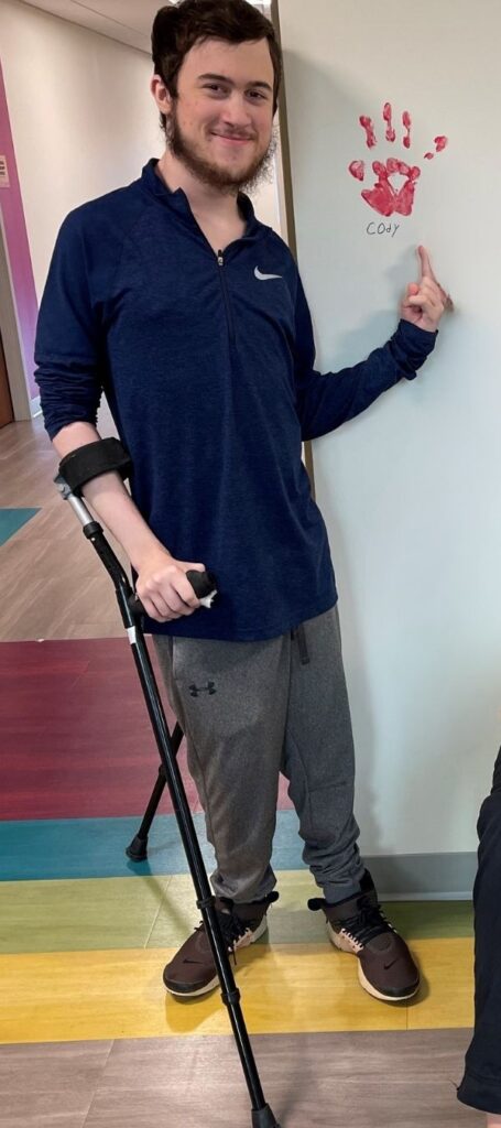 young man with a crutch pointing to his graduation handprint